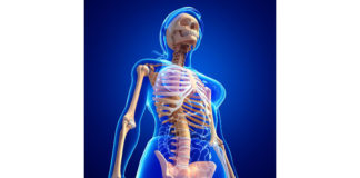 Osteoporosi e indice di massa corporea