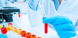 FDA, revisione prioritaria a emicizumab per emofilia A con inibitori FDA accorda la revisione prioritaria a emicizumab per l'emofilia A e accetta la BLA basandosi su studi in pazienti affetti da emofilia A con inibitori