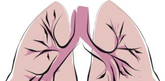 Dati a sei mesi su pirfenidone con nintedanib per la IPF