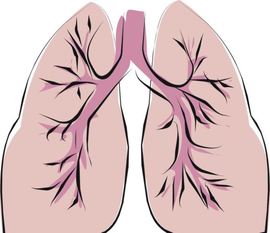 Dati a sei mesi su pirfenidone con nintedanib per la IPF