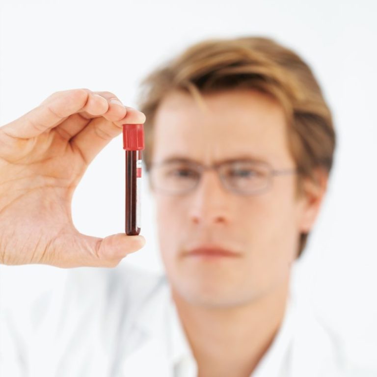 Rurioctocog alfa pegol per l’emofilia A