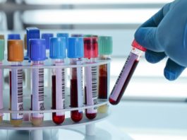 Octocog alfa protein free da cellule BHK per l’emofilia A
