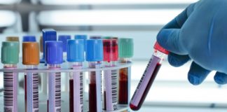 Octocog alfa protein free da cellule BHK per l’emofilia A