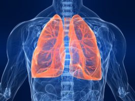 Test per la diagnosi precoce del tumore al polmone da campione ematico