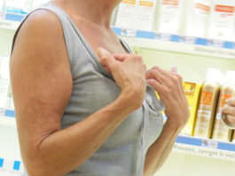 L’Orticaria cronica spontanea (CSU)