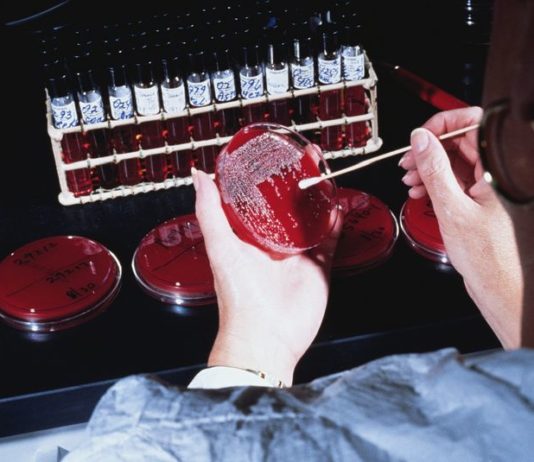 Infezioni correlate all’assistenza e antimicrobicoresistenza