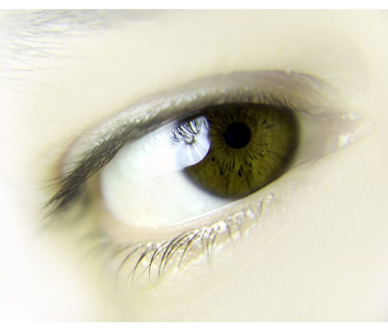 Rituximab per la neuromielite ottica