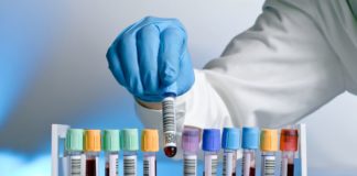 Aumento della sopravvivenza con carfilzomib per il mieloma multiplo