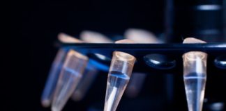 Analizzatori di ultima generazione per la medicina di laboratorio