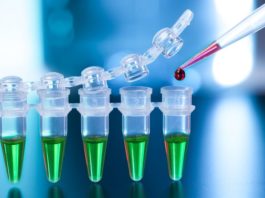 Studi testa-a-testa su secukinumab per spondilite anchilosante e AP