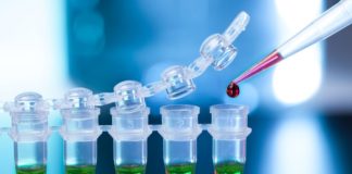 Studi testa-a-testa su secukinumab per spondilite anchilosante e AP