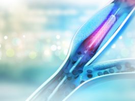Aggiornamento del Manuale per la classificazione dei dispositivi borderline Stent angioplasty procedure with placing a balloon