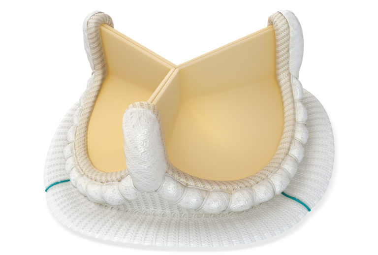 Nuova valvola aortica biologica Avalus