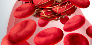 Biosimilare dell’enoxaparina sodica disponibile in Italia