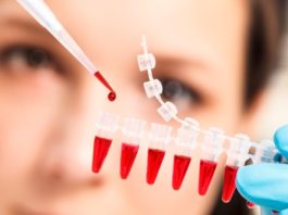 Combinazione sperimentale di GS-9620 e PGT121