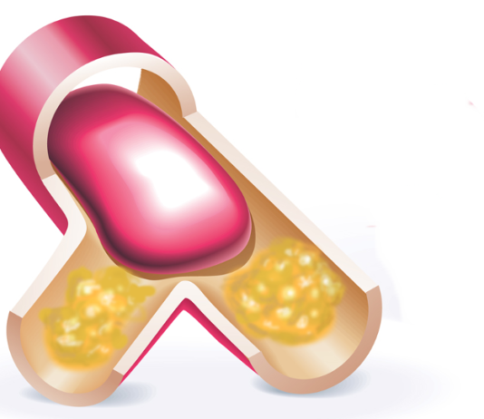 Evolocumab per la prevenzione del rischio cardiovascolare approvato dalla CE