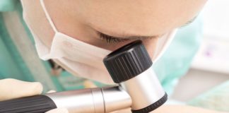 Cemiplimab per il carcinoma cutaneo a cellule squamose
