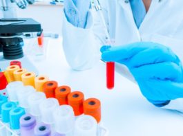 Influenza del pipettaggio sui risultati degli esami di laboratorio