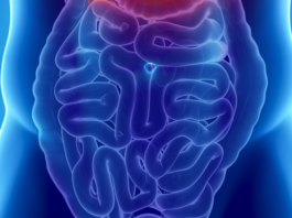 Informazioni in rete sulle malattie infiammatorie croniche intestinali