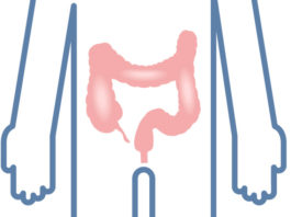 EMA approva tofacitinib citrato per la colite ulcerosa