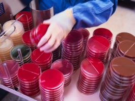 Parere positivo del CHMP dell’EMA su pegfilgrastim biosimilare di Sandoz