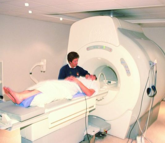 Dati a 8 anni su alemtuzumab per la sclerosi multipla