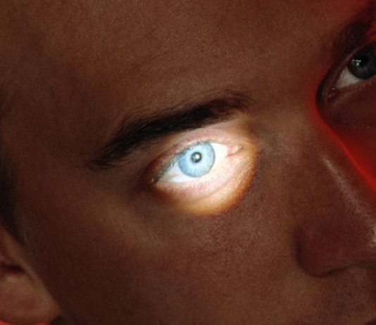 Femtolaser e lenti intraoculari innovano la chirurgia della cataratta