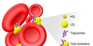 Nuovi dati sulla mortalità con alirocumab per l’ipercolesterolemia