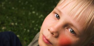 Priority review FDA di dupilumab per la dermatite atopica negli adolescenti Priority review FDA di dupilumab per la dermatite atopica negli adolescenti per i quali le terapie topiche non controllano adeguatamente la malattia o sono sconsigliate