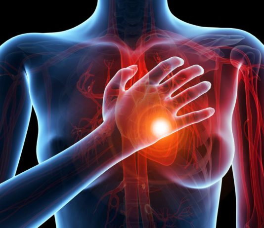 Malattie cardiovascolari nella donna