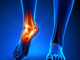 Percezione e gestione del dolore in emofilia