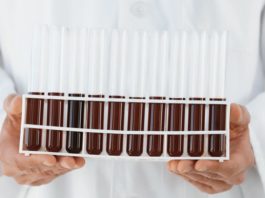 Il NICE raccomanda venetoclax per la leucemia linfatica cronica Il NICE raccomanda venetoclax per la leucemia linfatica cronica già trattata in precedenza (in combinazione con rituximab) nel Servizio Sanitario Inglese