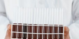 Il NICE raccomanda venetoclax per la leucemia linfatica cronica Il NICE raccomanda venetoclax per la leucemia linfatica cronica già trattata in precedenza (in combinazione con rituximab) nel Servizio Sanitario Inglese
