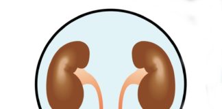 Avelumab in associazione con axitinib per il carcinoma renale metastatico