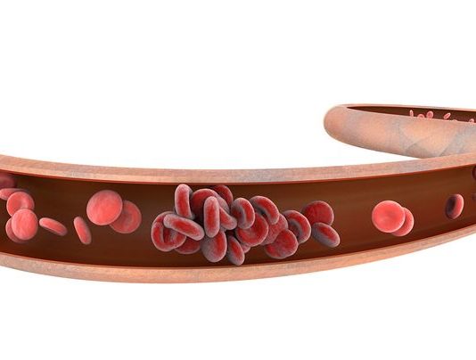 Approvata da AIFA la rimborsabilità di rivaroxaban 10 mg Approvata da AIFA la rimborsabilità di rivaroxaban 10 mg in monosomministrazione giornaliera per TVP ed EP e per la prevenzione delle recidive