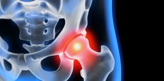 Progetto su un biomateriale per migliorare le protesi all’anca Il progetto EVPRO cerca un biomateriale per migliorare le protesi all'anca che sia in grado di controllare l’infiammazione di migliorare la rigenerazione ossea