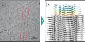 Svelata la struttura delle fibre di amiloide cardiaca