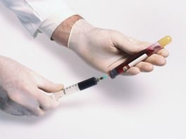 Parere favorevole del CHMP dell’EMA alla prima terapia genica per la TDT