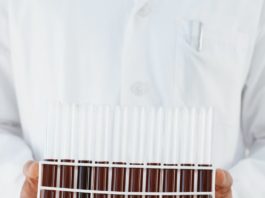 AIFA autorizza lo studio clinico di CAR-T CD44v6 per AML e MM AIFA ha autorizzato lo studio clinico di CAR-T CD44v6 di MolMed per la leucemia mieloide acuta (AML) e per il mieloma multiplo (MM)