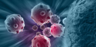 L’EMA convalida la domanda di A.I.C. di pexidartinib per il TGCT