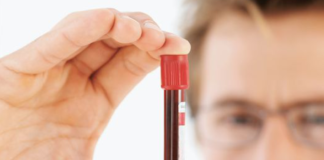 Obinutuzumab per il linfoma follicolare in prima linea Obinutuzumab per il linfoma follicolare avanzato non pretrattato è rimborsabile per i pazienti a rischio intermedio e alto secondo l’indice FLIPI