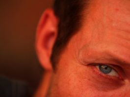 Collirio dal siero cordonale per il glaucoma