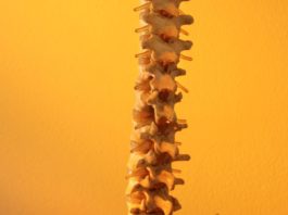 L’impatto della spondilite anchilosante