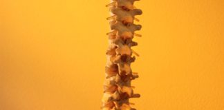 L’impatto della spondilite anchilosante