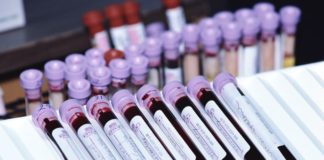 Dati a 5 anni su blinatumomab per la leucemia linfoblastica acuta Dati a 5 anni su blinatumomab per la leucemia linfoblastica acuta in pazienti con malattia minima residua