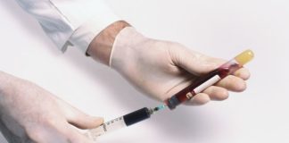 Ravulizumab per l’emoglobinuria parossistica notturna Alexion Pharma Italy annuncia l’approvazione della Commissione Europea di ravulizumab per l'emoglobinuria parossistica notturna