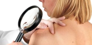 AIC europea a cemiplimab per il carcinoma cutaneo CS avanzato