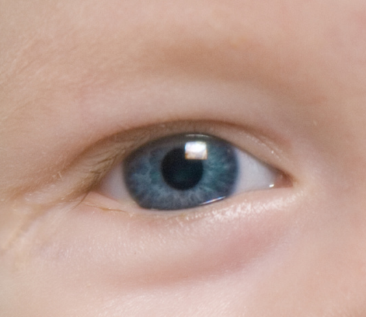 Parere del CHMP su ranibizumab per la retinopatia del prematuro