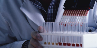 Rimborsabile la prima terapia CAR-T per il DLBCL e la LLA a cellule B