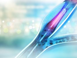 Stent ultrasottile a rilascio di farmaco